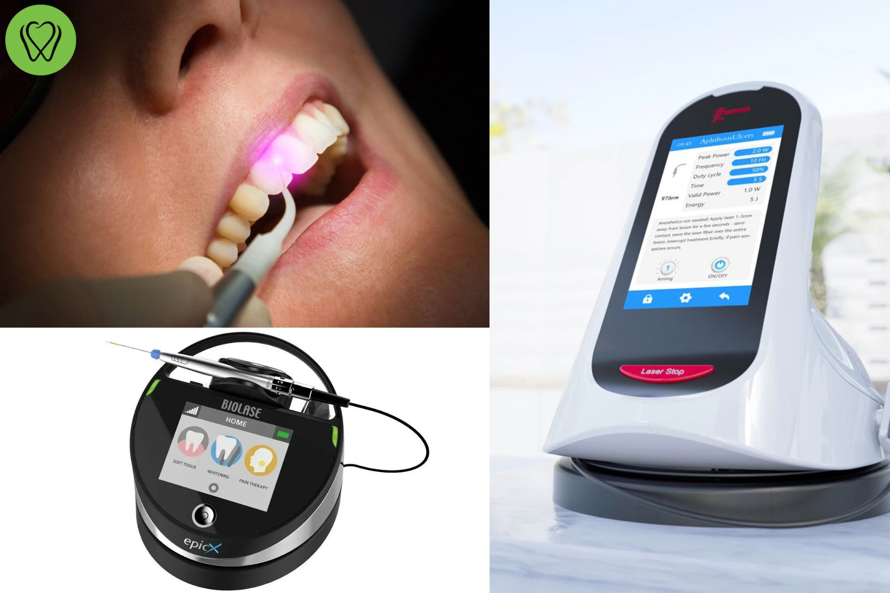 Dental Laser Treatments