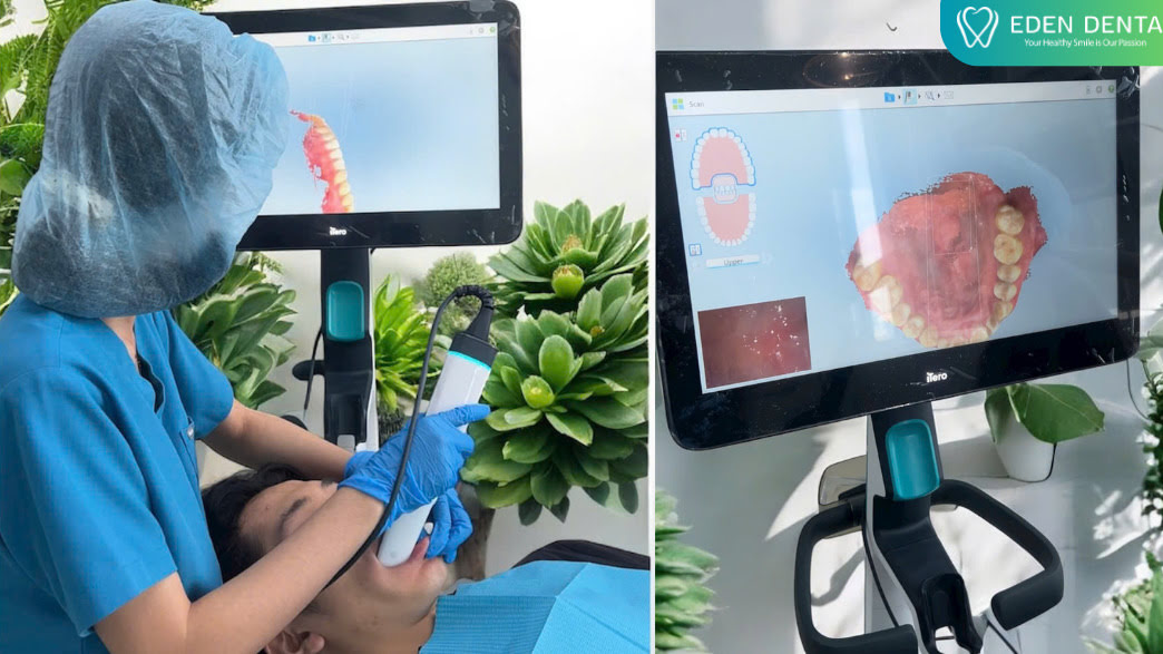 Digital Dental WorkFlow
