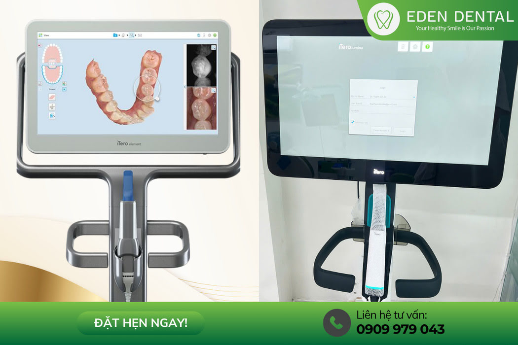 Oral Scanner Technology